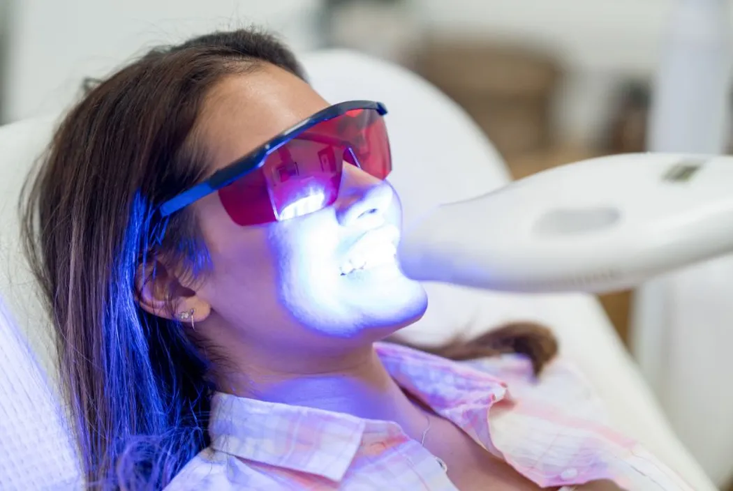 Zalety laserowego wybielania zębów: Dlaczego warto wybrać tę metodę?